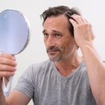 Андрогенная алопеция: причины выпадения волос и методы лечения