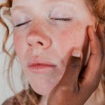 Как осветлить пигментные пятна на лице