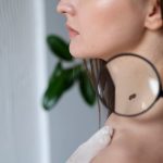 Как распознать родинку, требующую внимания?