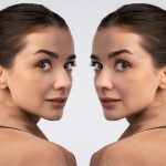 Как работает методика Full Lift и в чем ее отличие от Full Face?