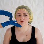 Все замерло: когда колоть ботокс и может ли он навредить