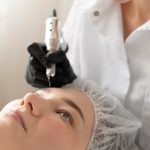 Микроигольчатый лифтинг: важные детали перед процедурой