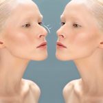 Как изменились носы знаменитостей: семь примеров успешной ринопластики