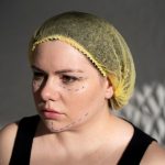 Сколько стоит сделать шрам на лице, как у Энн Хэтэуэй в фильме «Ведьмы»