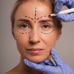 Звездные преображения: пластика, которая удалась