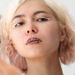 Как скорректировать форму губ, подбородка, носогубных складок и профиль без хирургии: советы ортодонта