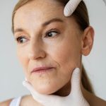 Как избавиться от постакне: советы от специалиста