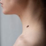 Поможет ли чистотел от родинки?