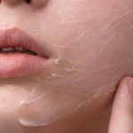 Расширенные поры